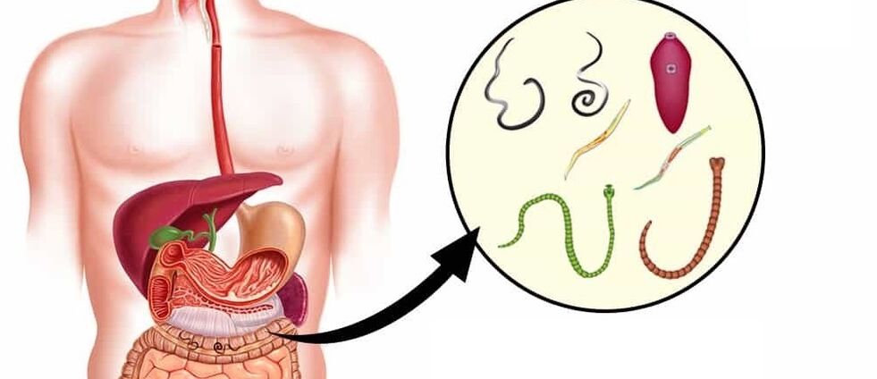 Паразити в човешкото тяло