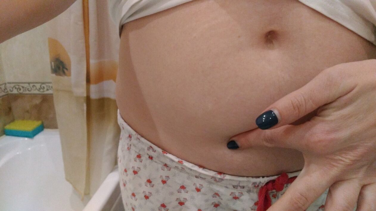 Признаци на хелминтна инфекция от личен опит