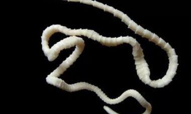 как да премахнете цестодния паразит от тялото