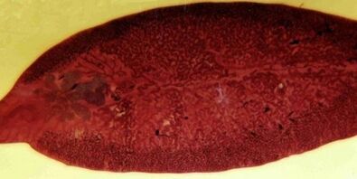 трематоден паразит как да се премахне от тялото