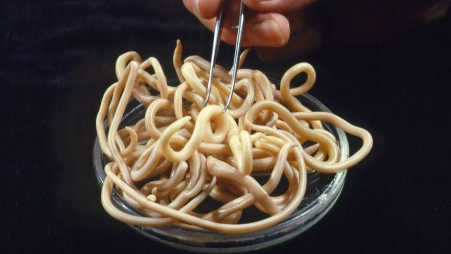 паразити от човешкото тяло